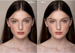 Retouch4me Heal 1.010 Full